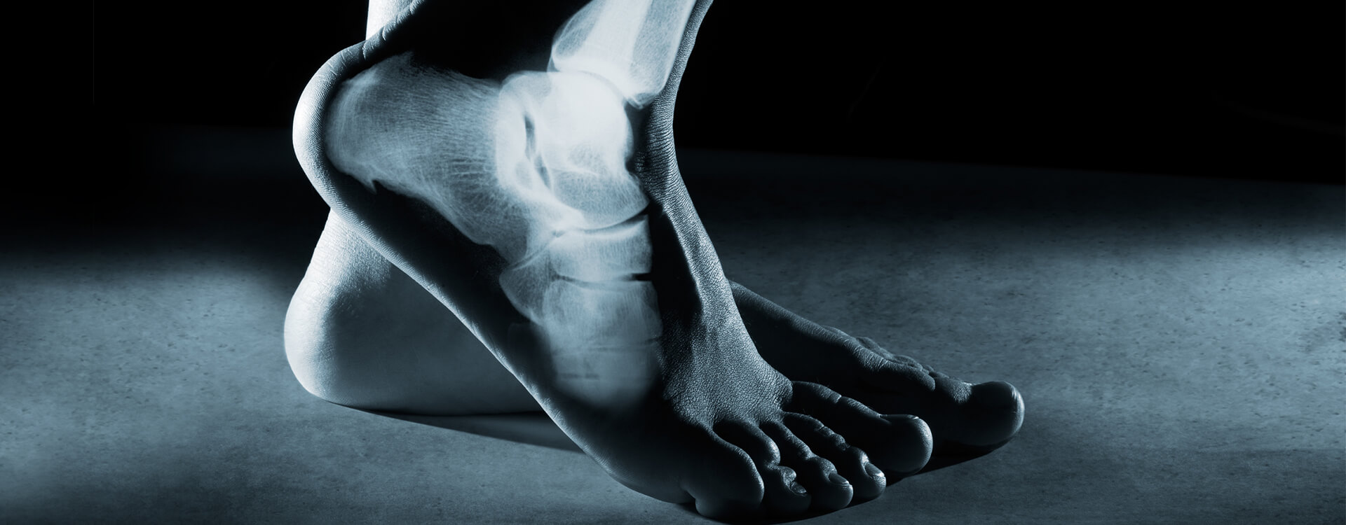 ankle digital x-ray