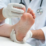 Podiatrist examines the foot on the presence of athlete's foot