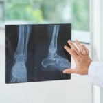 Unrecognizable medical practitioner examining X-ray picture of legs near window in doctor's office
